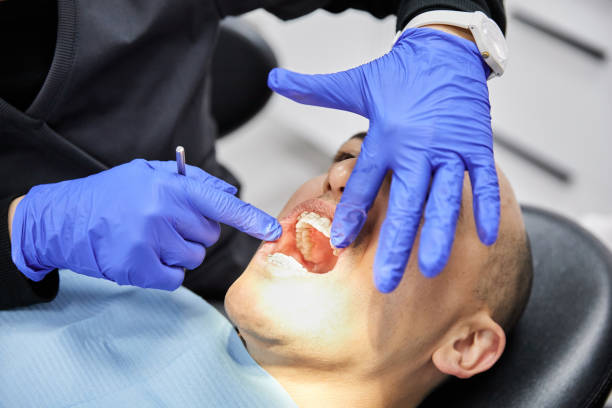 Best Knocked-Out Tooth (Avulsed Tooth) Treatment in Pawhuska, OK