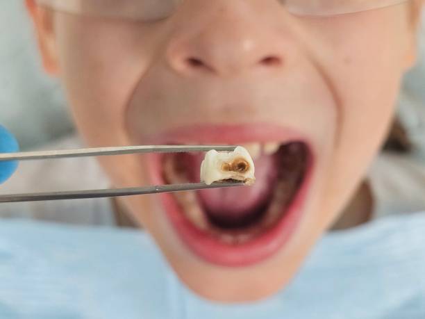 Best Broken or Chipped Tooth Repair in Pawhuska, OK