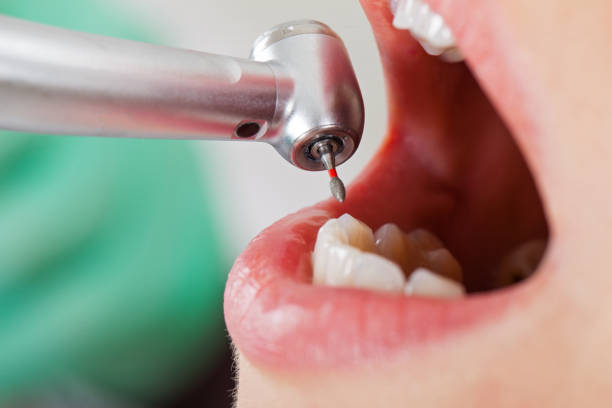 Best Emergency Denture Repair in Pawhuska, OK